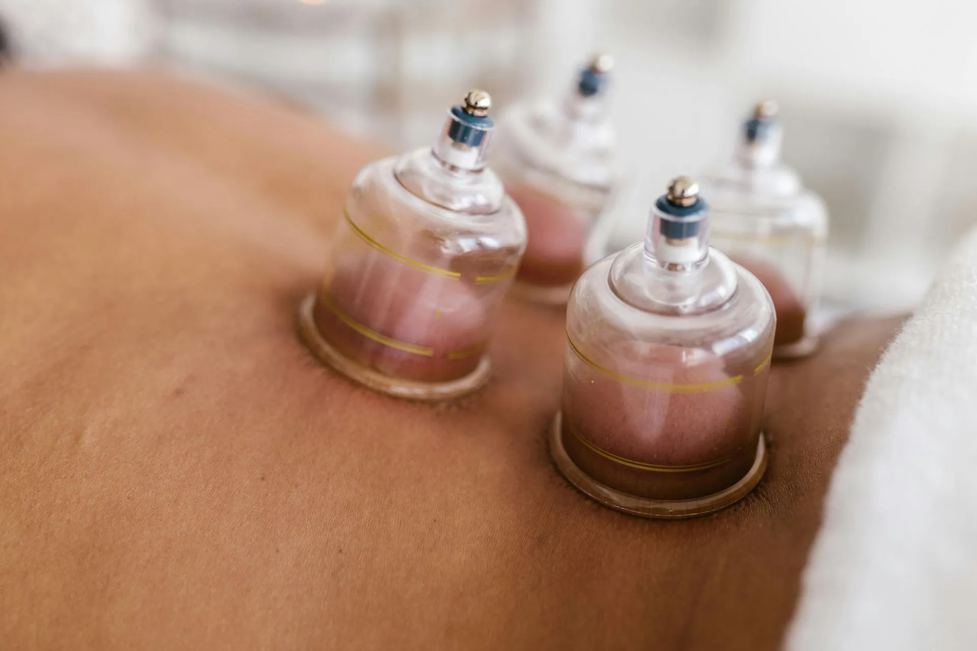 Cupping / IASTM